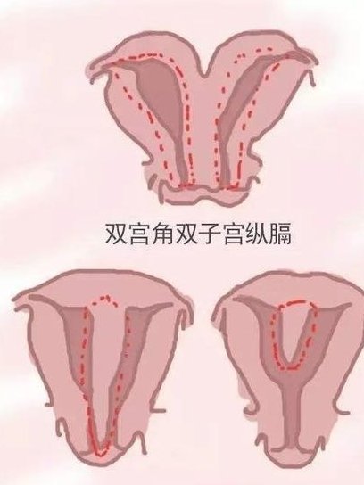 hiv去贵港做三代试管贵吗？大概要花费多少钱？
