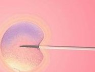 广西如何做三代试管婴儿省费用？