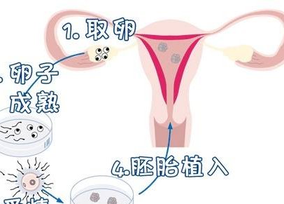 宫颈肥大做试管能成功吗