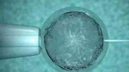 怎么样可以做三代试管婴儿，你怎么知道？